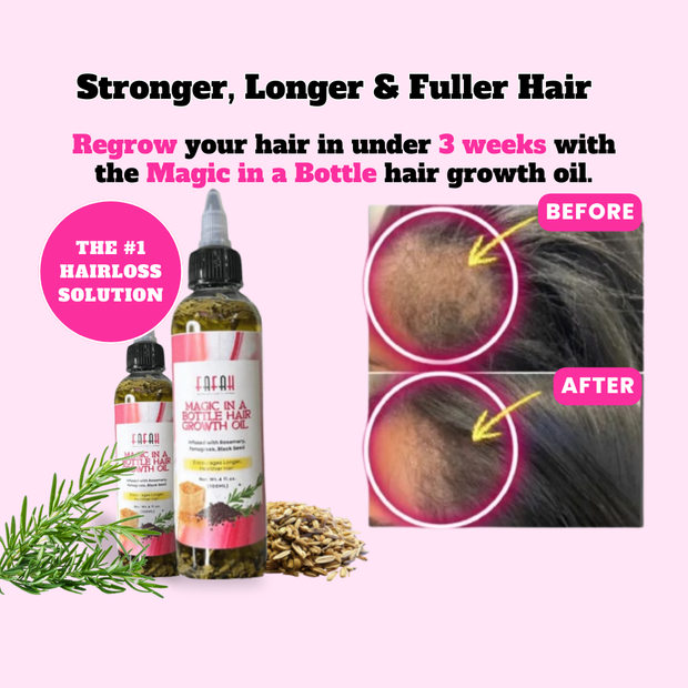 ✨ Magic Hair Growth Oil for Thicker, Fuller & Longer Hair ✨ 3 Bottle Value Bundle